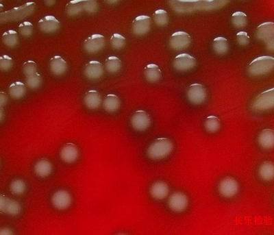 表皮葡萄球菌_360百科