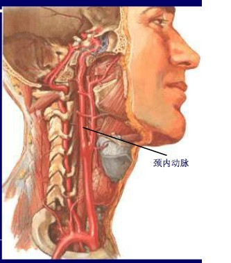 颈动脉解剖分段及狭窄的腔内治疗