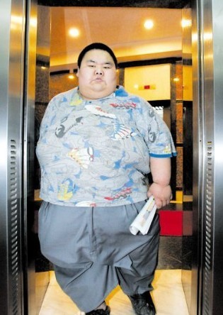 中国第一肥胖人孙亮图片